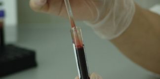 Šta treba izbegavati dan pre analize krvi?