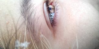 “Mušice” u vidnom polju moglu da budu znak ozbiljnog problema