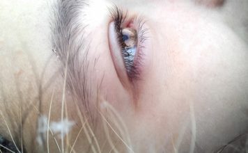 “Mušice” u vidnom polju moglu da budu znak ozbiljnog problema