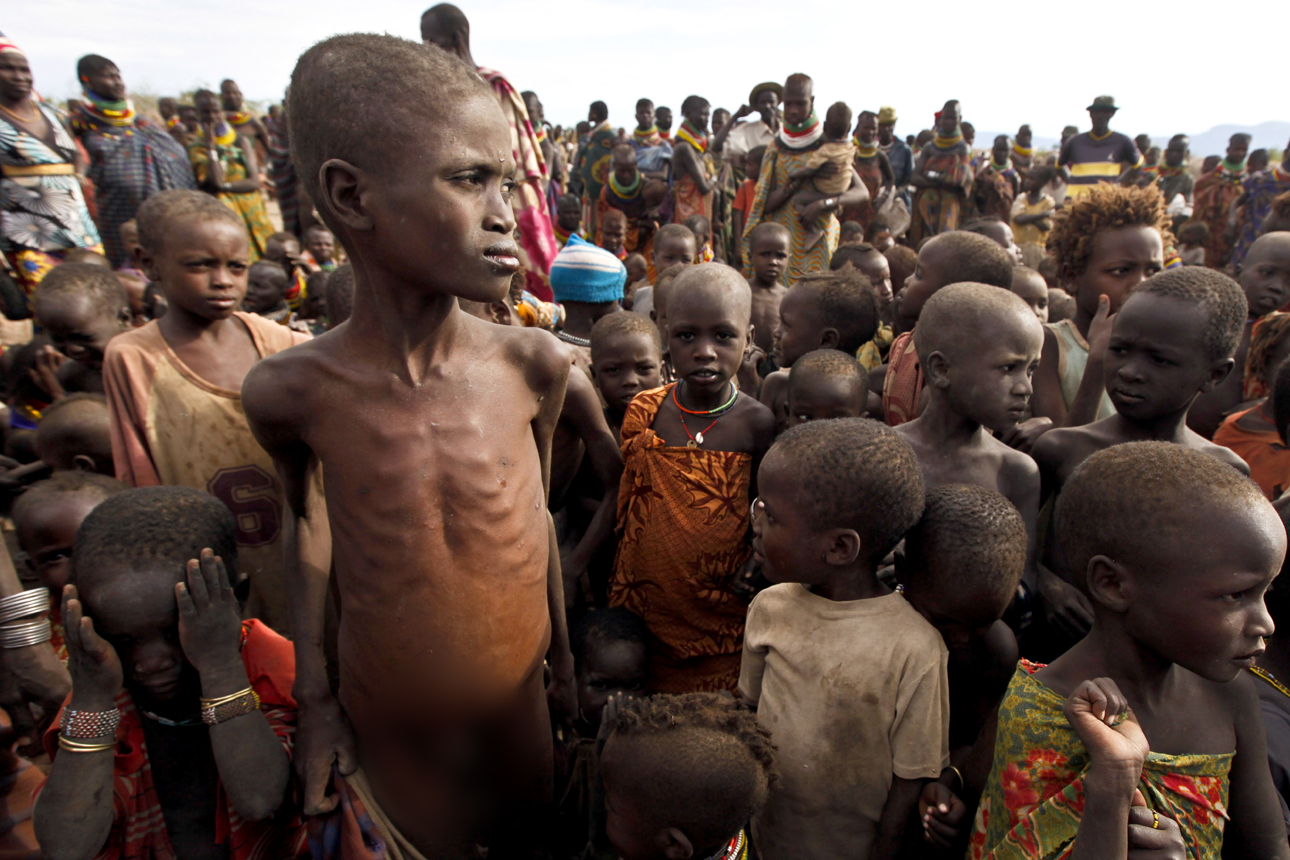 Избавление от голода. Голодающие народы Африки.
