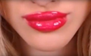 Dala je 460 evra za punije usne i dobila pakao (VIDEO)