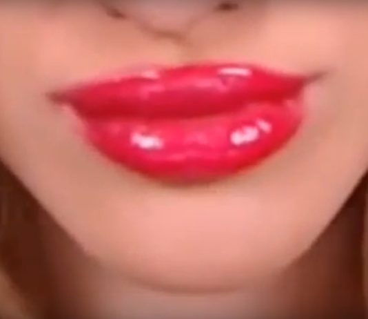 Dala je 460 evra za punije usne i dobila pakao (VIDEO)