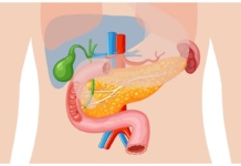 Ovo su glavni okidači za upalu pankreasa