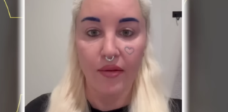 Nekad omiljena tinejdž zvezda i harizmatična slatkica, a danas ne liči na sebe (FOTO)